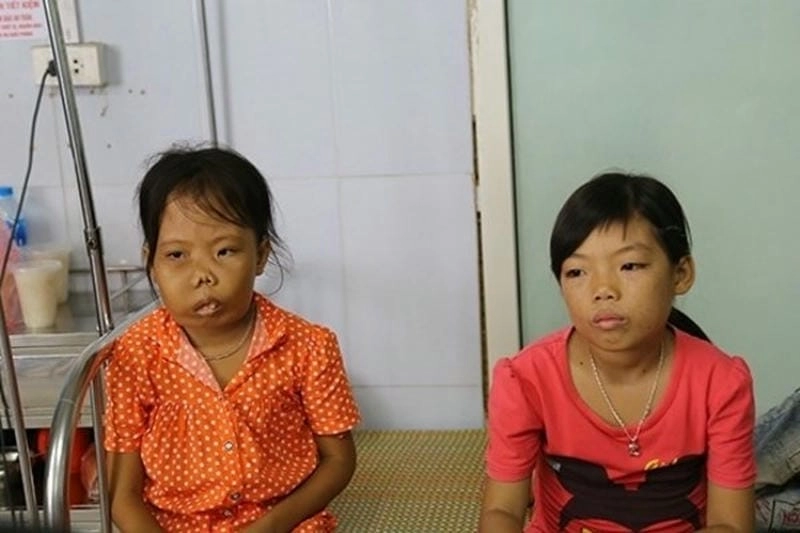 Cảnh báo bệnh tan máu di truyền qua hình ảnh lâm sàng cụ thể