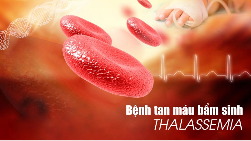 Tổng hợp hình ảnh bệnh tan máu bẩm sinh dễ nhận biết