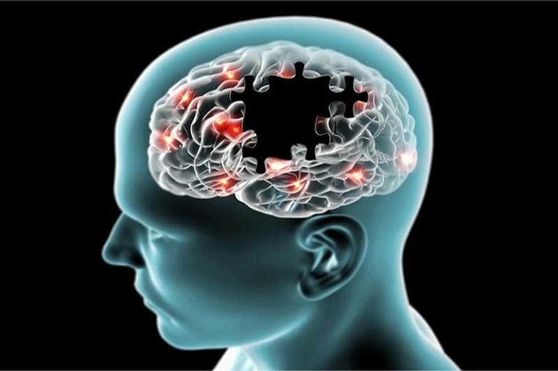 Hình ảnh thực tế về bệnh alzheimer ở người già thường gặp