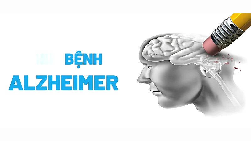 Nhận diện hình ảnh bệnh Alzheimer qua giai đoạn đầu