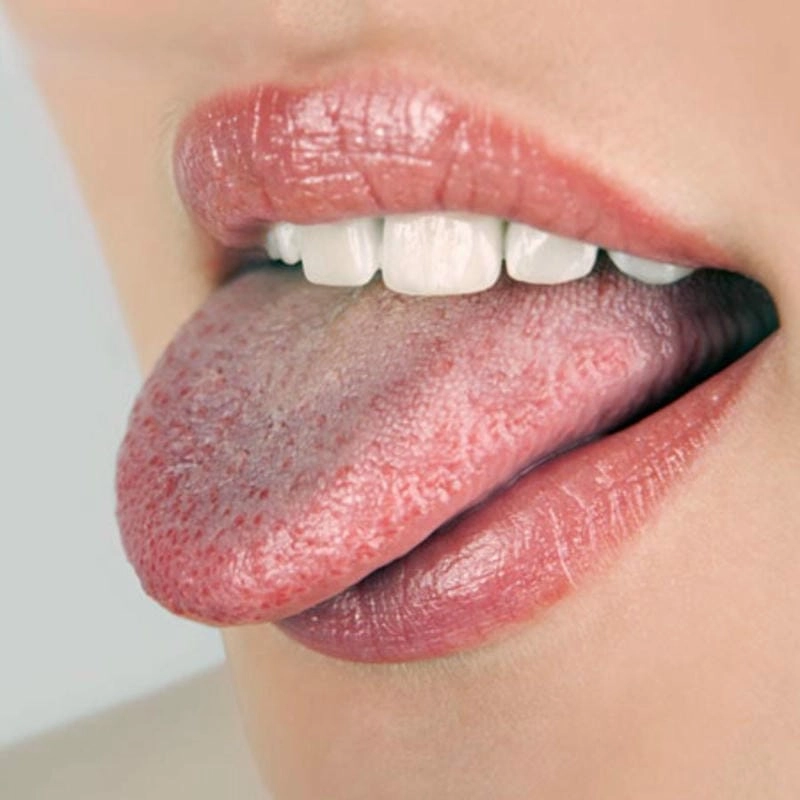 Tìm hiểu liệu bạch biến có lây không qua hình ảnh