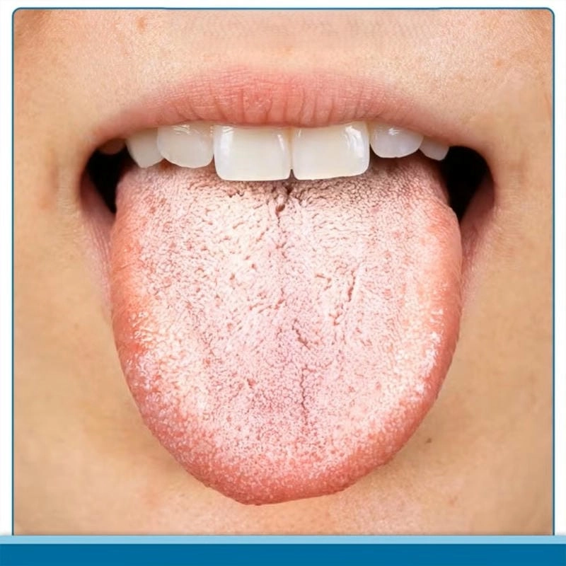 Quan sát kỹ hình ảnh bạch biến ở tay thực tế
