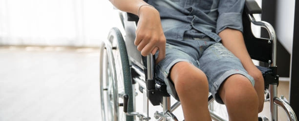 Tư liệu hình ảnh về người bị bại liệt chi tiết