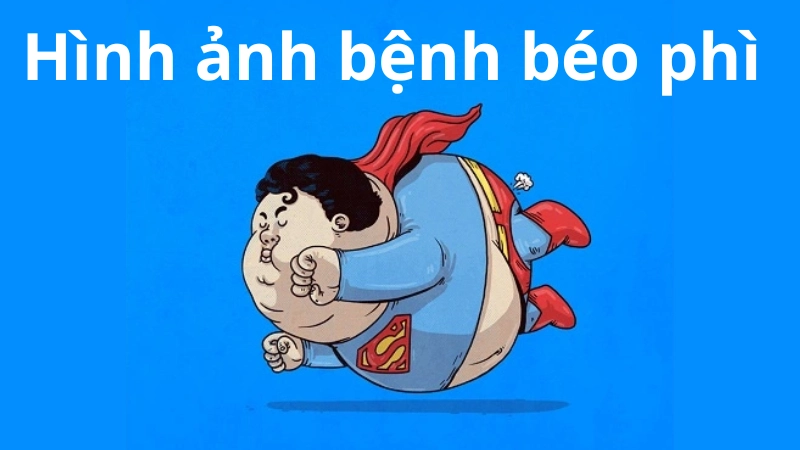 Nhận biết sớm qua hình ảnh bệnh béo phì điển hình