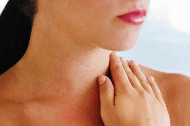 Nhận biết bướu cổ nhẹ sớm nhờ hình ảnh bệnh bướu cổ