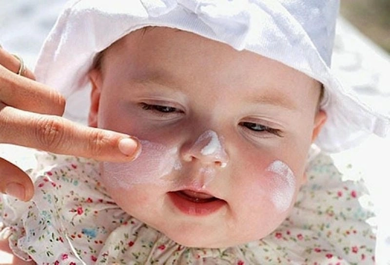 Tìm hiểu nhanh hình ảnh bé bị chàm sữa phổ biến