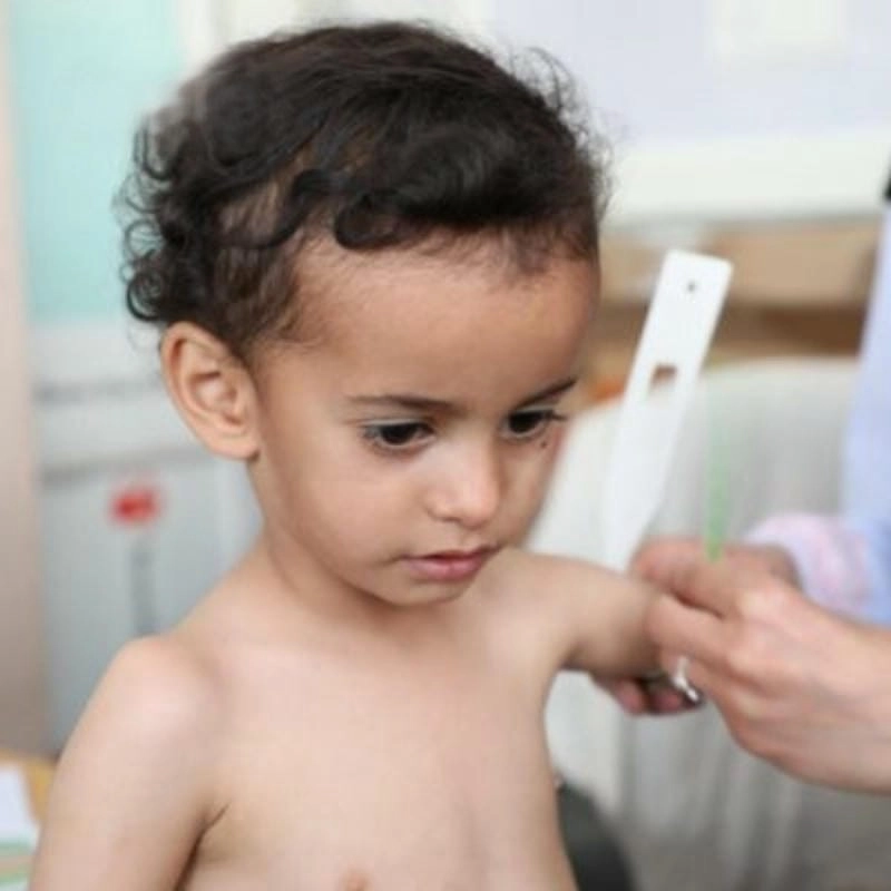 Khi bé bị còi xương cần bổ sung canxi và tắm nắng