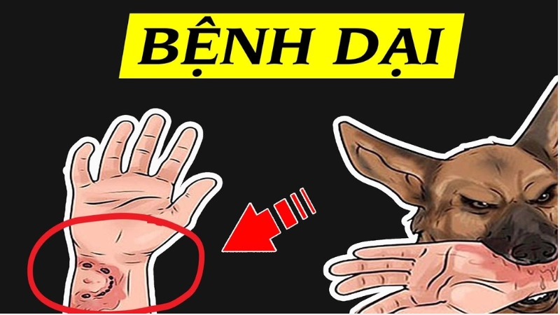Hình ảnh bệnh dại chi tiết qua từng giai đoạn nguy hiểm