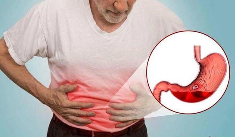 Chớ coi thường triệu chứng đau dạ dày