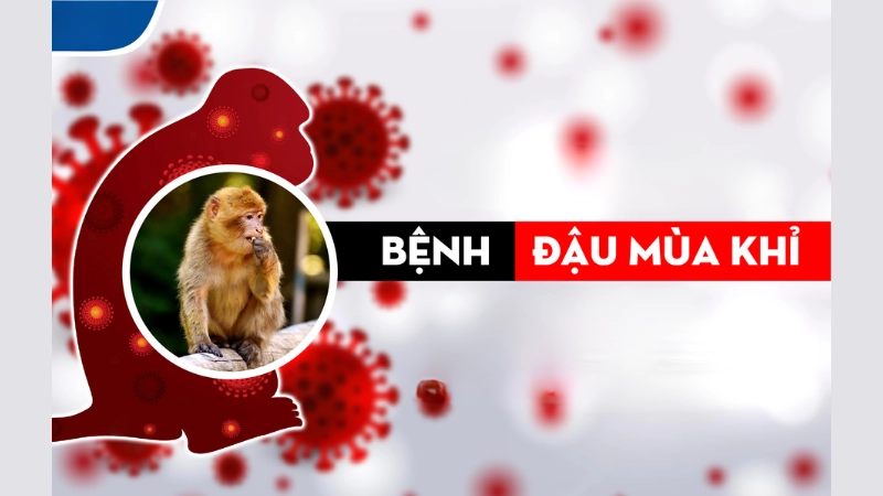Những dấu hiệu qua hình ảnh bệnh đậu mùa khỉ đầu tiên
