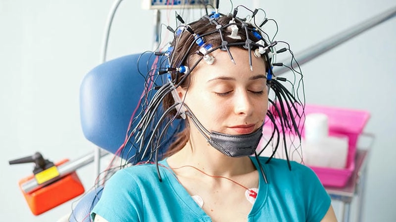 Dấu hiệu dễ thấy trong hình ảnh trẻ bị bệnh động kinh