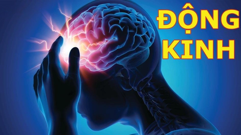 Xem ngay hình ảnh bệnh động kinh dễ nhận biết triệu chứng