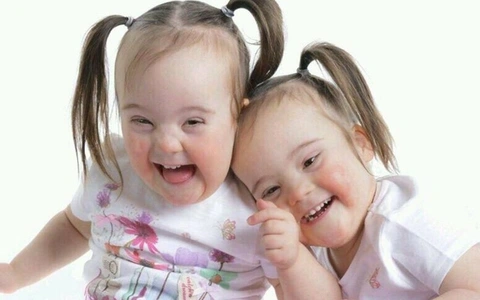 Cuộc sống thường ngày của bệnh nhân down