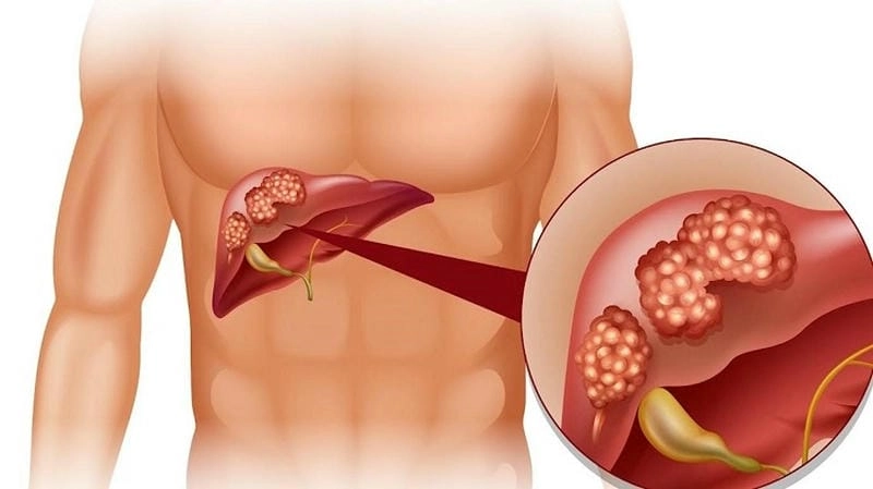 Cận cảnh hình ảnh gan trong có thể người chân thực
