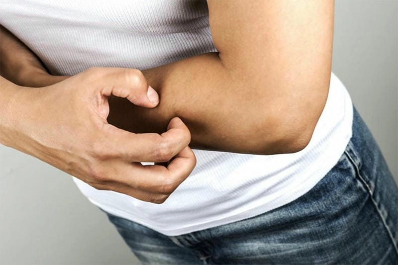 Chi tiết thực tế về hình ảnh ghẻ ruồi ngoài da