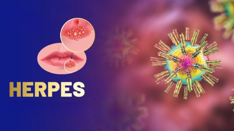Cảnh báo dấu hiệu qua hình ảnh bệnh herpes thực tế