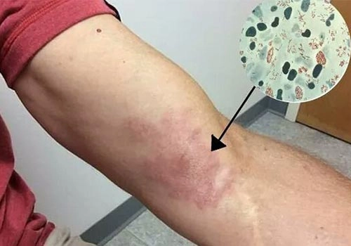 Cuộc sống thực tế của người bị bệnh hủi