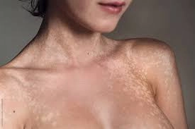 Tham khảo thêm hình ảnh lang beng thực tế