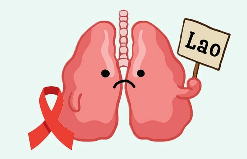 Khám phá hình ảnh bệnh lao phổi chi tiết dễ hiểu