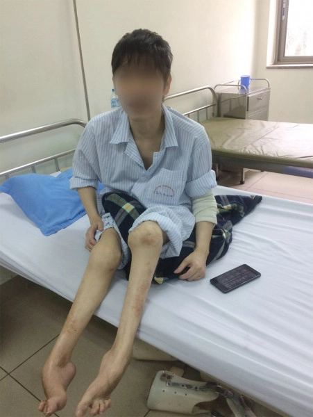 Tìm kiếm chi tiết ảnh máu khó đông