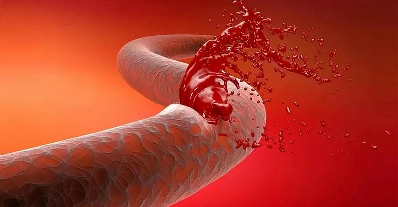 Không thể tin nổi ảnh hiện tượng máu khó đông