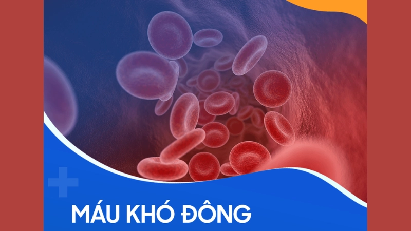 Nhận biết qua hình ảnh bệnh máu khó đông trên cơ thể