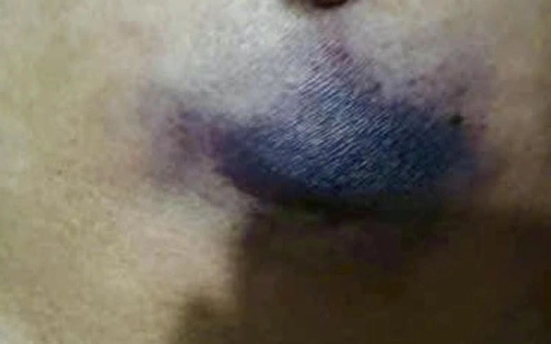 Hình ảnh cá rồng bị nấm đen ở vảy lưng