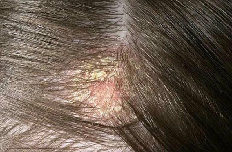 Xu hướng tóc nam kiểu ảnh nam đầu nấm năm nay
