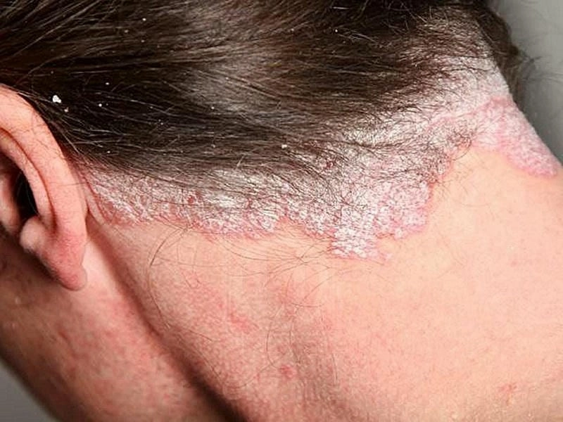Tổng hợp kiểu tóc ảnh đầu nấm đẹp cá tính