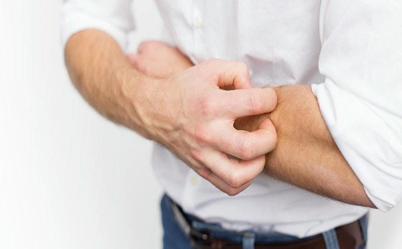 Xem ngay hình ảnh phong ngứa ở tay chi tiết