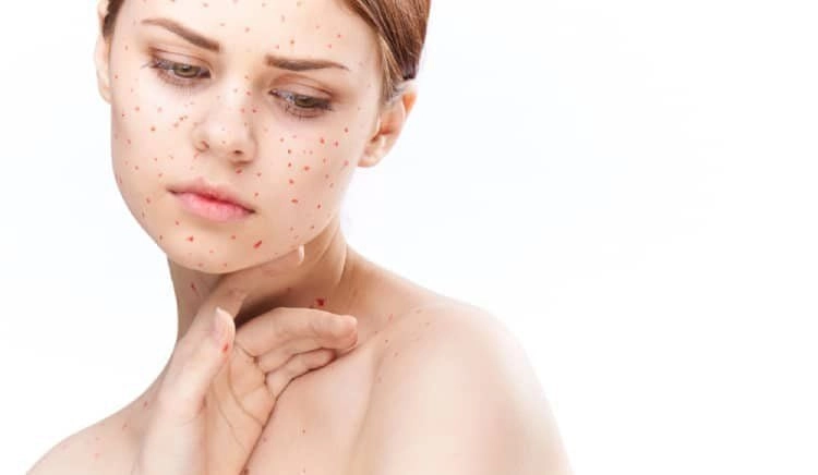 Hình ảnh bệnh rubella thần kinh hiếm gặp nhưng nguy hiểm