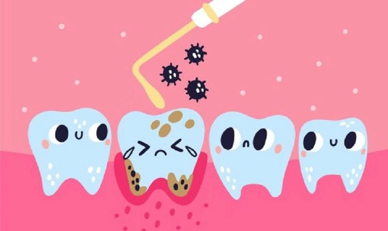 Hậu quả nếu xem nhẹ hình ảnh người bị bệnh sâu răngg