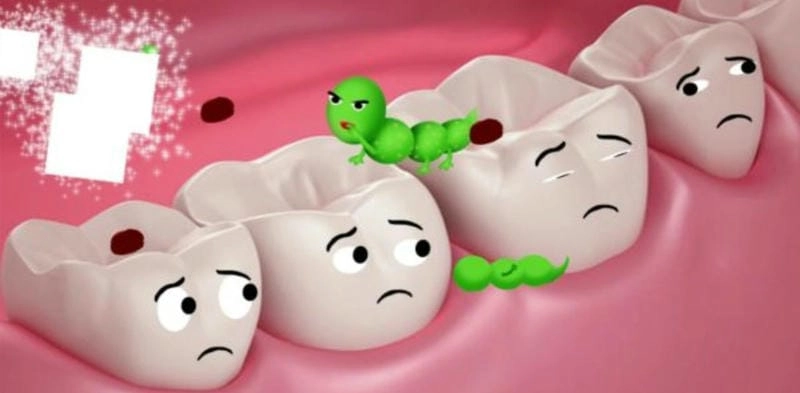 Tham khảo nhanh các ảnh đau răng điển hình