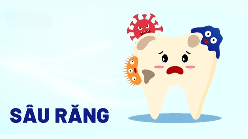 Nhận biết bệnh qua hình ảnh bệnh sâu răng thực tế