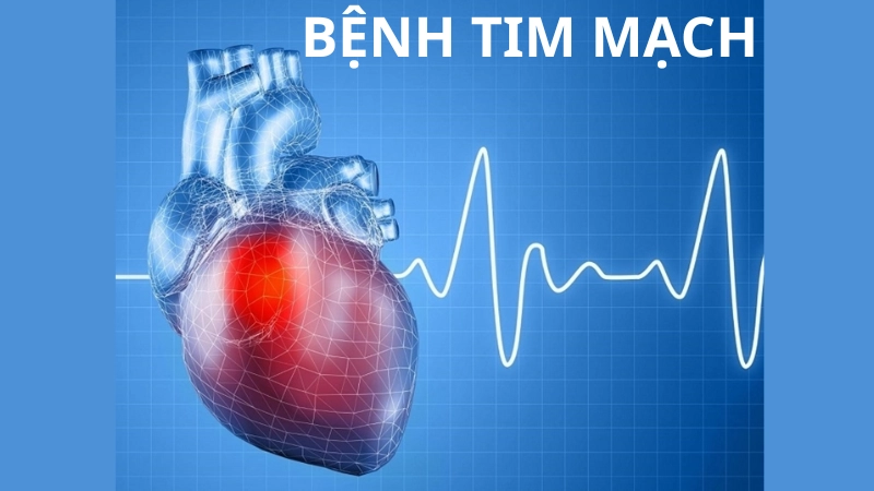 Tổng hợp hình ảnh bệnh tim mạch thường gặp hiện nay