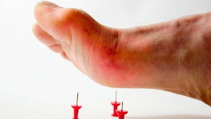 Tổng hợp các triệu chứng uốn ván thường gặp