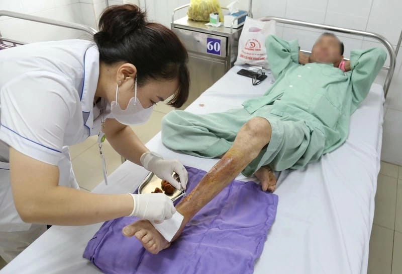 Cẩn trọng với vì khuẩn ăn thịt người gây chết người