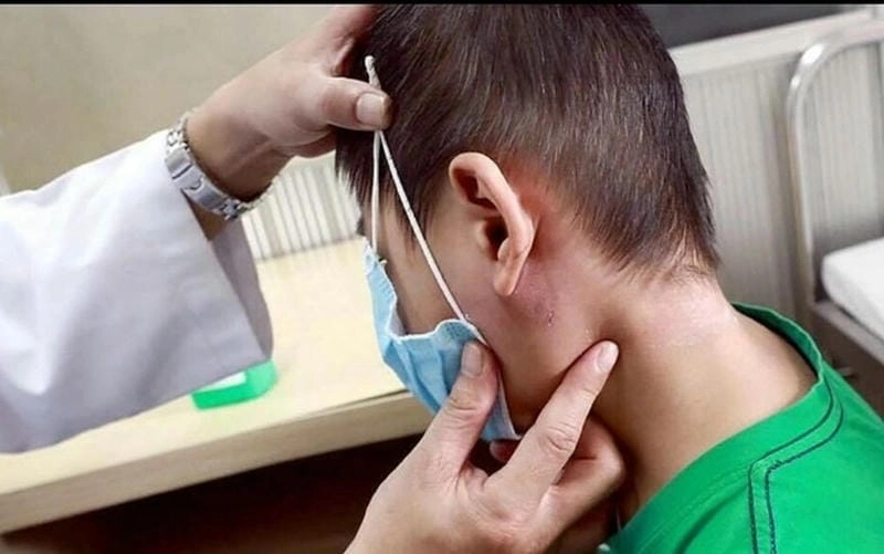 Xem ngay hình ảnh vi khuẩn an thịt người chi tiết