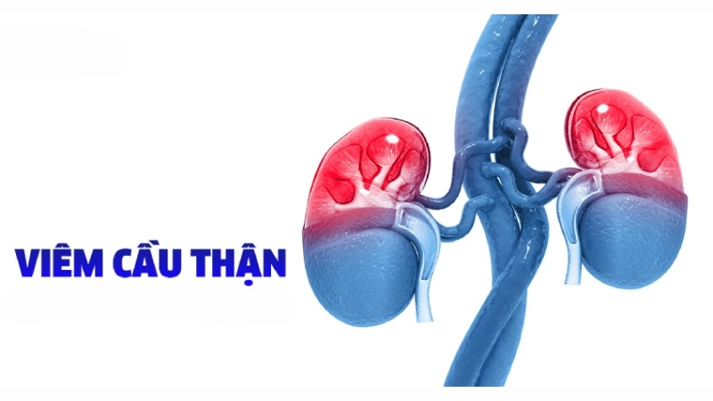 Nhận biết sớm qua hình ảnh bệnh viêm cầu thận thực tế