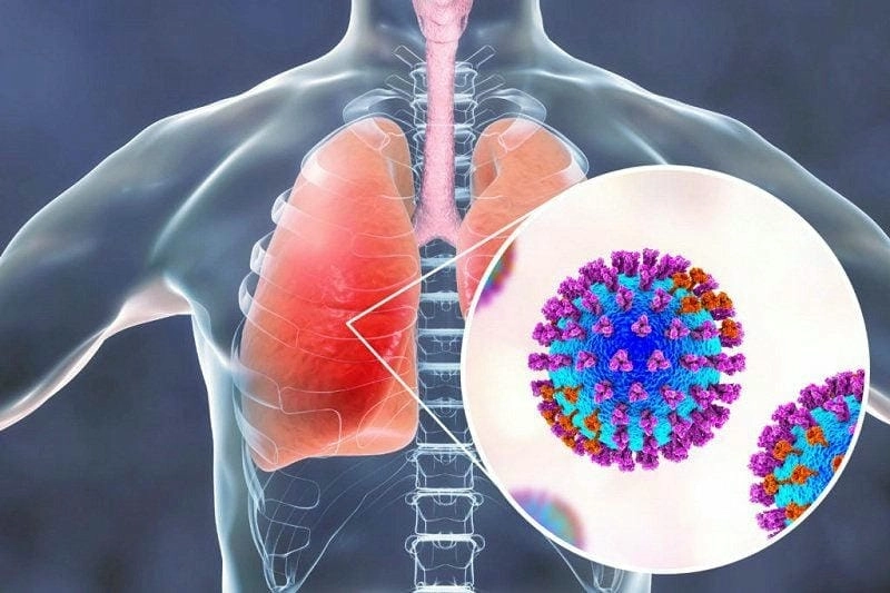 Nhìn rõ triệu chứng qua viêm phổi ở trẻ em