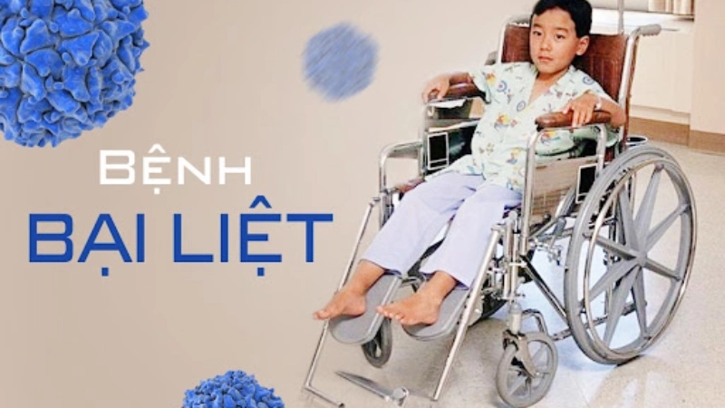 Hình ảnh bệnh bại liệt phục vụ truyền thông y tế