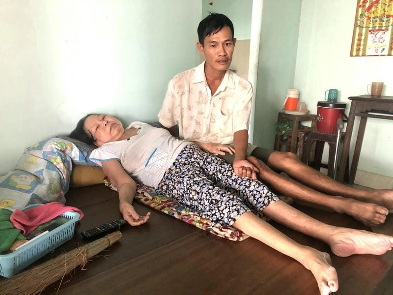 Cuộc sống của người bị bại liệt qua hình ảnh thực tế