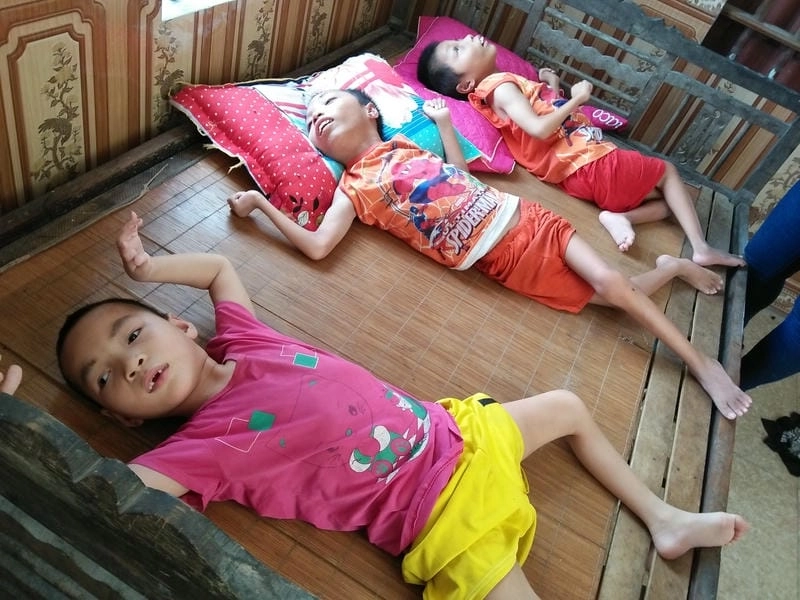 Hình ảnh trẻ bại liệt cần được chăm sóc y tế sớm