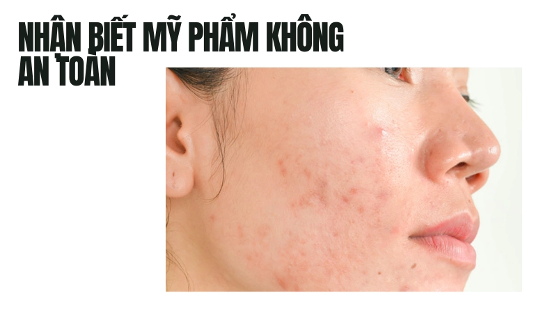 Dấu hiệu thường gặp của mỹ phẩm kém