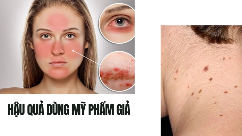 Hậu quả sức khỏe khi dùng mỹ phẩm giả 