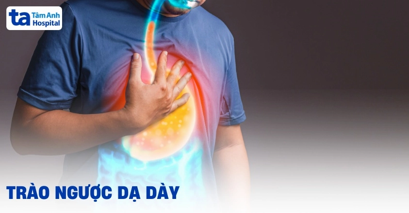 Tô màu chữ trào ngược dạ dày