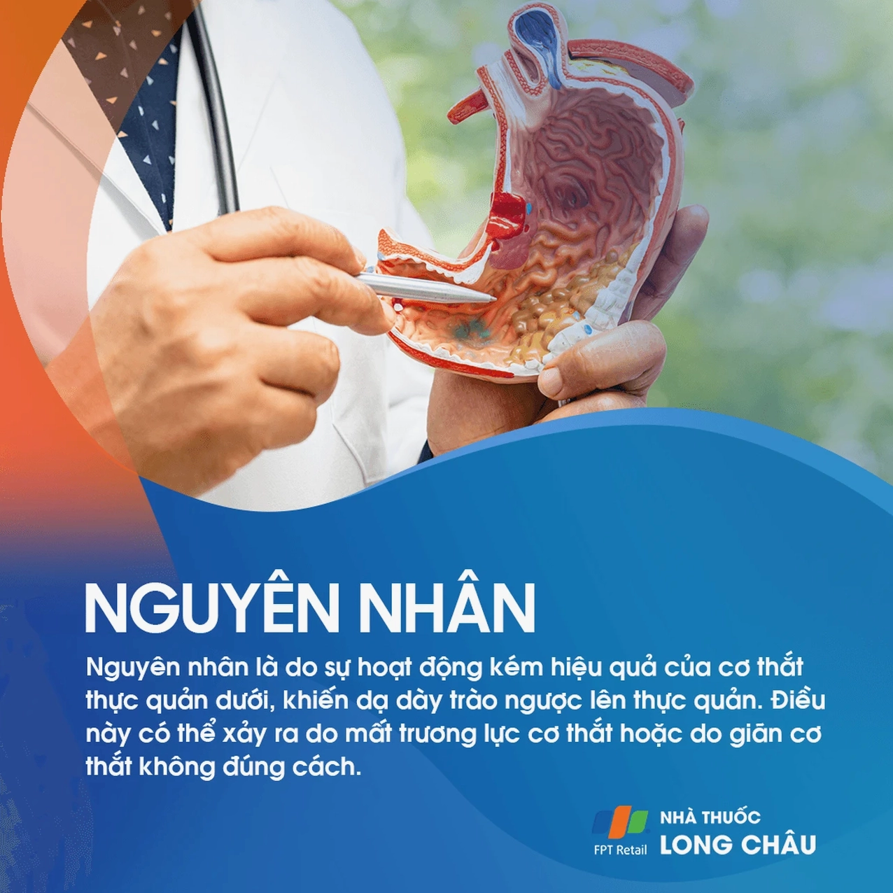 Tô màu cơ thắt thực quản yếu gây trào ngược