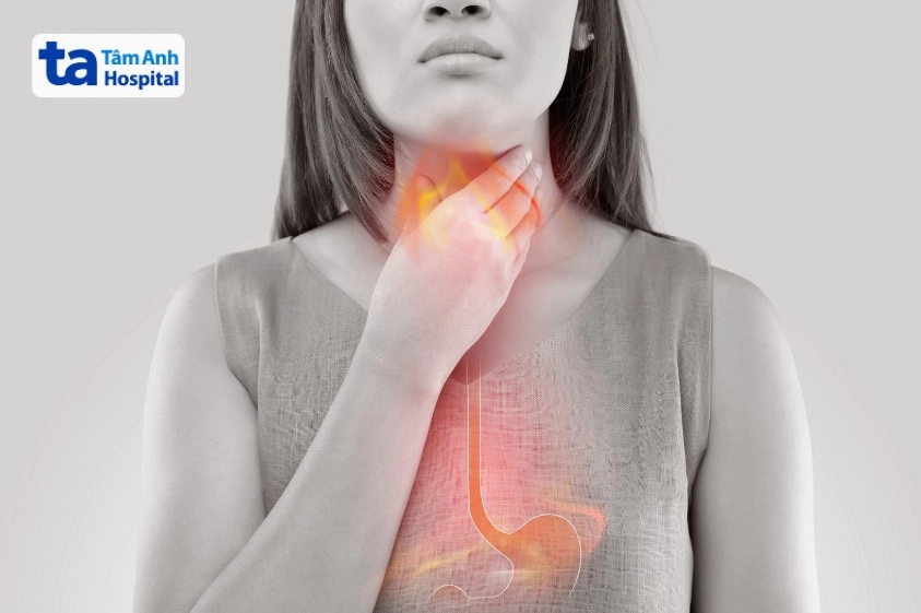 Tô màu hiện tượng trào ngược dạ dày