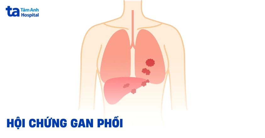 Tô màu lá phổi và lá gan vui nhộn