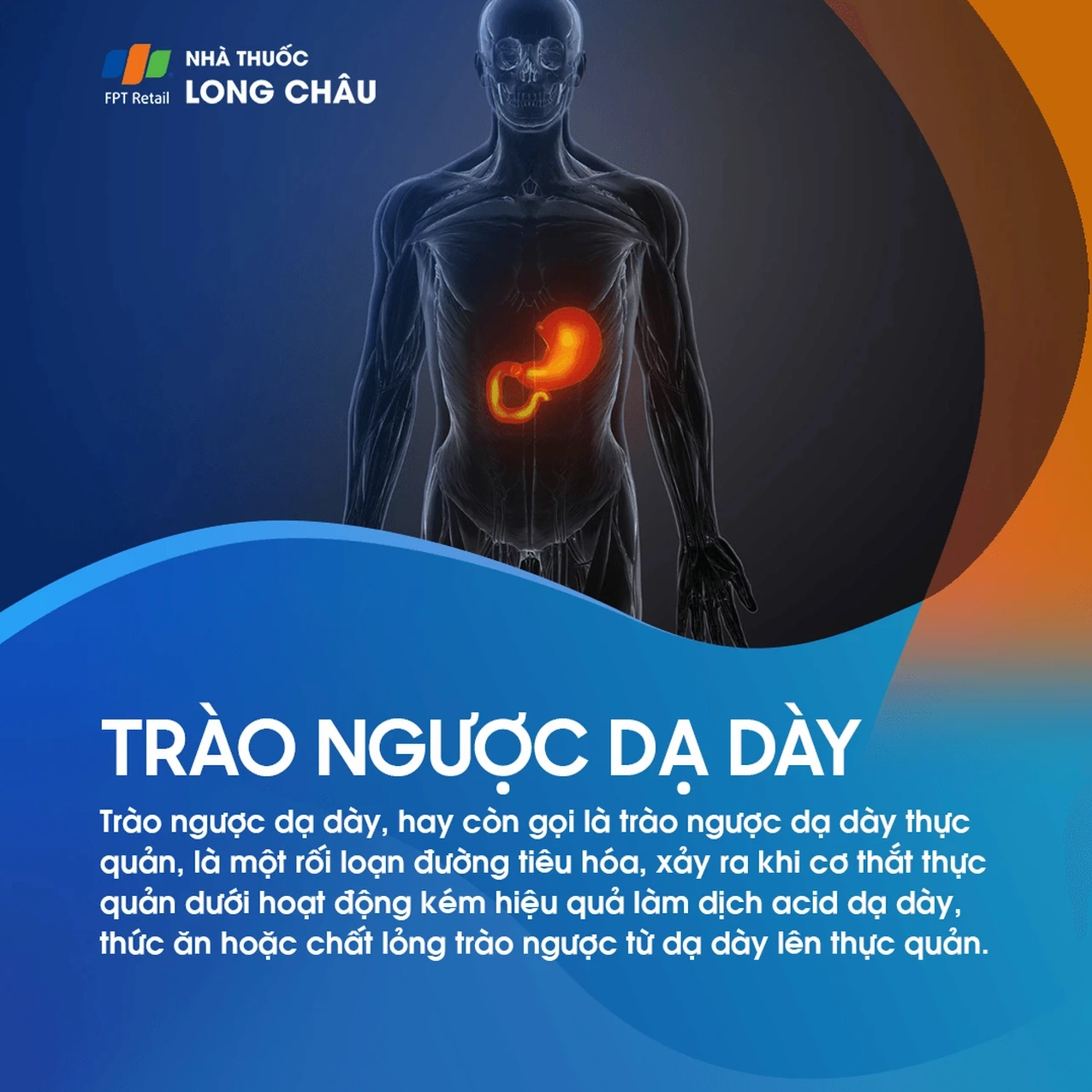 Tô màu thắc mắc trào ngược dạ dày thực quản là bệnh gì